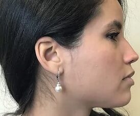 right side profile