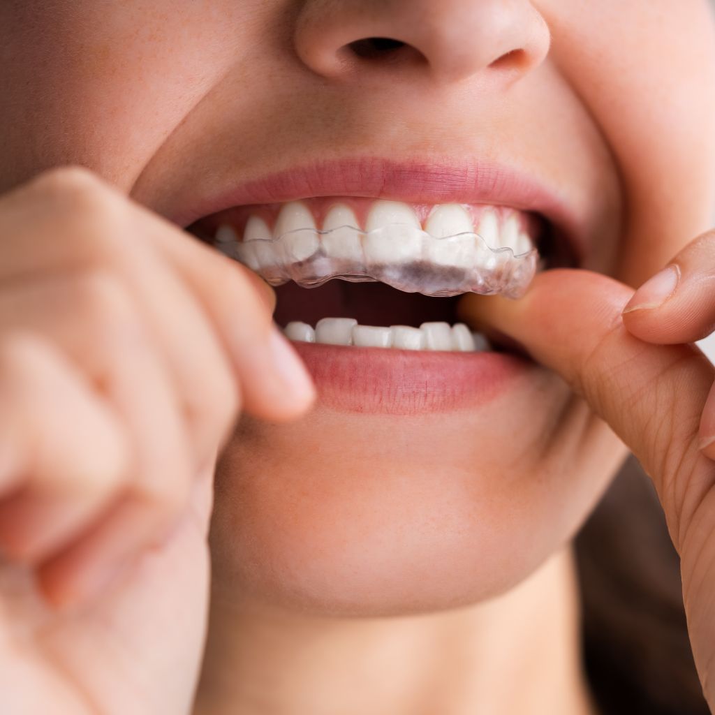 night guard night guard