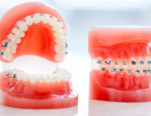 Understanding the Differences Between Child, Teen, and Adult Orthodontic Treatment