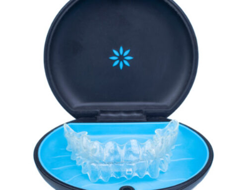 4 Tips for Caring for Your Retainer