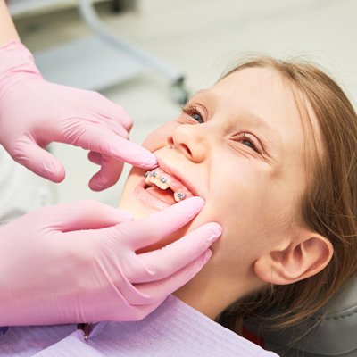 Braces for child teeth correction