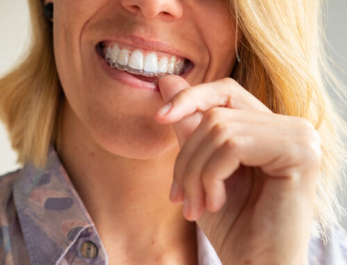 5 Common Myths About Invisalign® Debunked