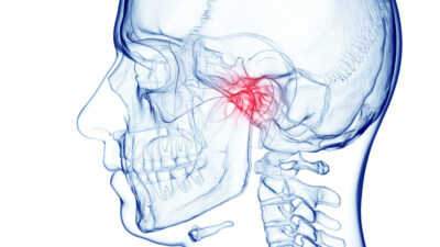 3d rendered medical illustration of male anatomy - skull and cervical spine. jaw pain. plain white background. professional studio lighting.