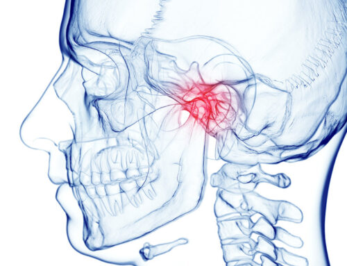 How Orthodontics Can Help with TMJ Pain and Jaw Misalignment