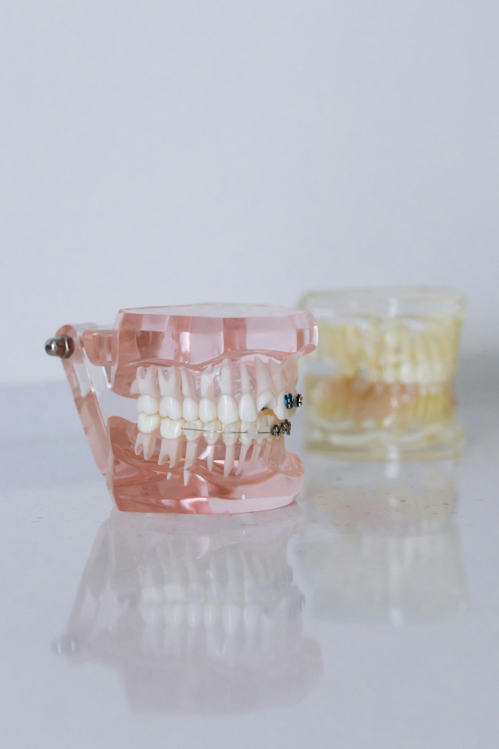 Close-Up Shot of Dentures