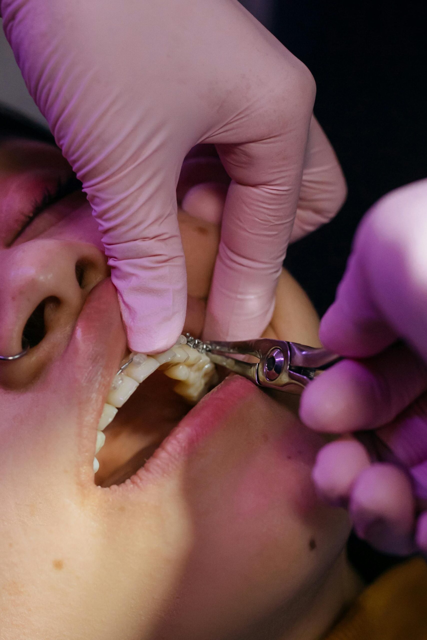 Close-up Photo of Dentist Examining Patient's Teeth