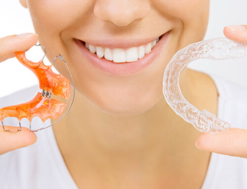 Retention After Orthodontic Treatment: Our Proven System for Maintaining Your New Smile