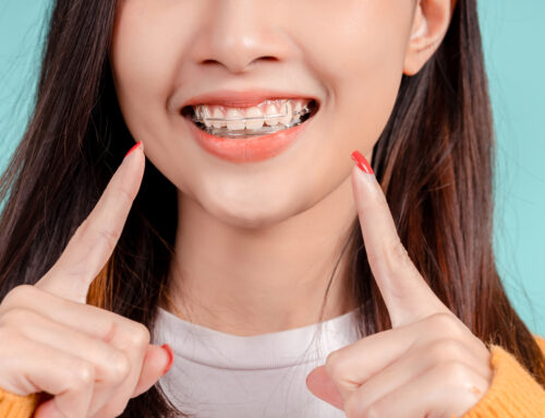 How to Maintain Your Results After Invisalign® Treatment