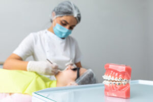 Orthodontic model and dentist tool. Teeth model of varities of orthodontic bracket or braces