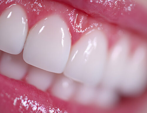 How Proper Bite Alignment Prevents Future Dental Programs