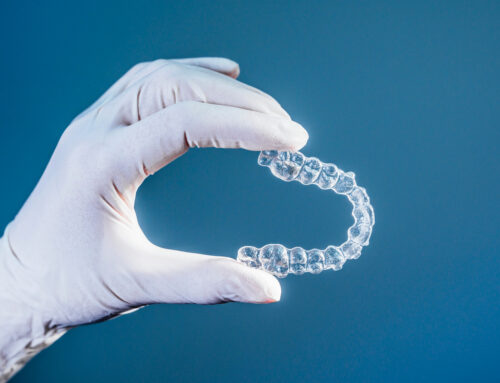 The Clemente Difference: How Personal Treatment Planning Creates Superior Invisalign® Results