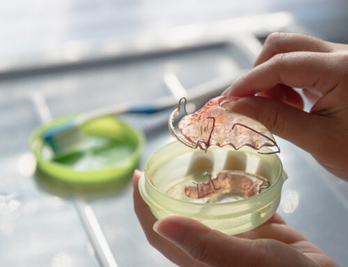 What Happens If You Don’t Wear Your Retainer? The Truth About Relapse