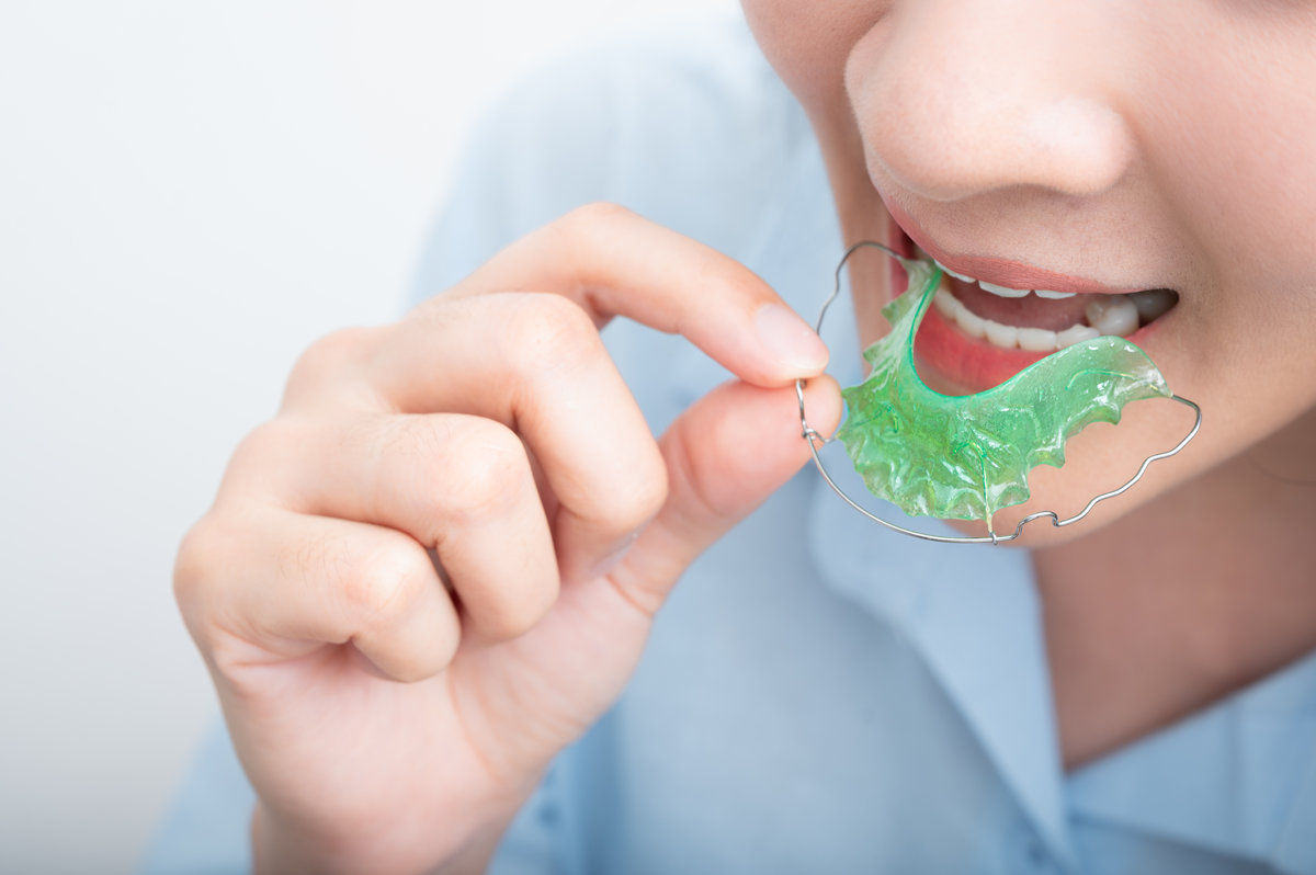 Asian woman wareing orthodontic retainers.Teeth retaining tools after braces .