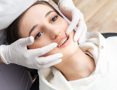 Managing Discomfort During Orthodontic Treatment: Tips from Our Experienced Team