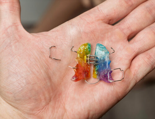 How to Handle a Lost or Broken Retainer: Emergency Steps
