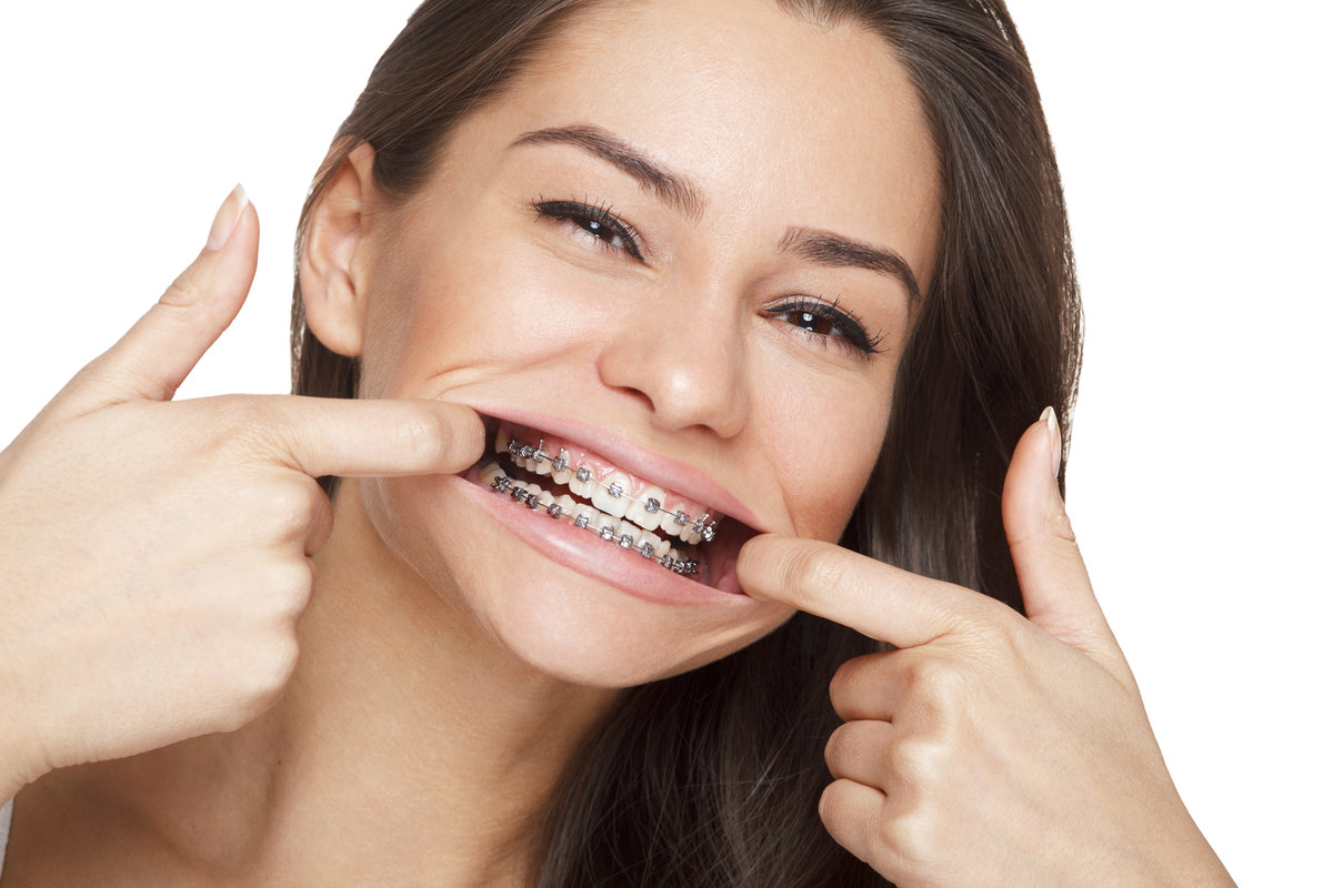 Face of a young woman with braces on her teeth Airways and Orthodontics