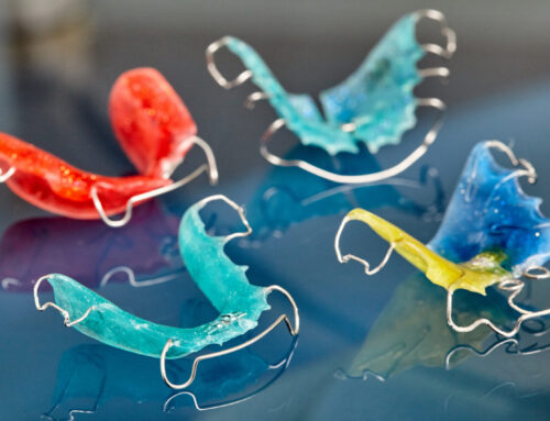 Why Do Retainers Hurt? How to Manage Retainer Pain and When to Call Your Orthodontist