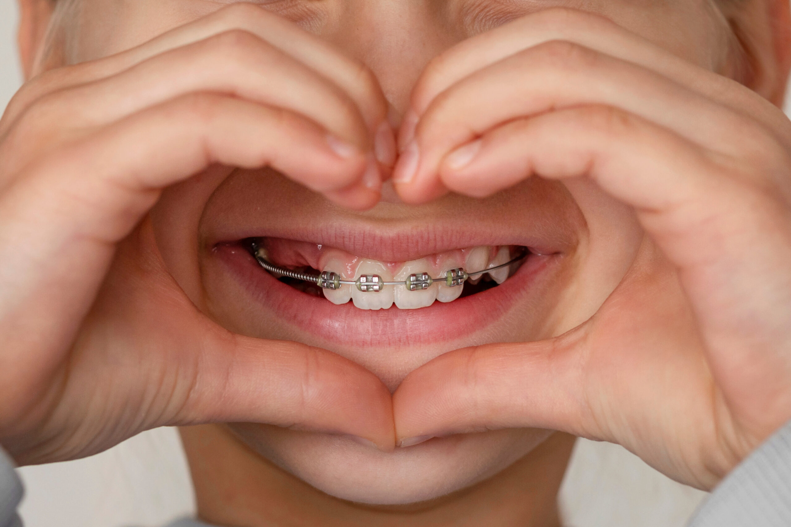 Airways and Orthodontics