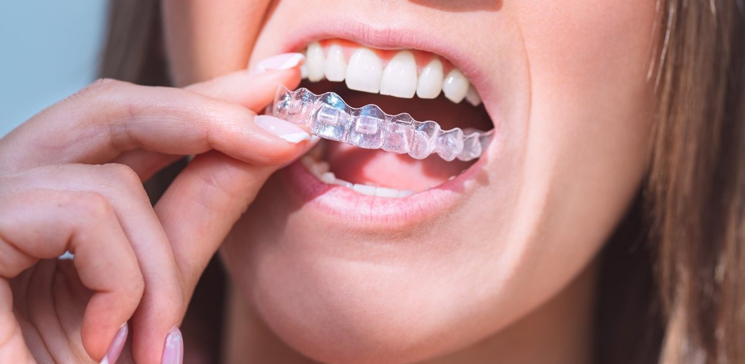 Woman with a healthy smile holding a clear Invisalign tray